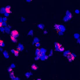 B7-H7/HHLA2 was detected in immersion fixed human peripheral blood mononuclear cells (PBMCs) using Mouse Anti-Human B7-H7/HHLA2 Monoclonal Antibody (Catalog # MAB80841) at 25 µg/mL for 3 hours at room temperature. Cells were stained using the NorthernLights™ 557-conjugated Anti-Mouse IgG Secondary Antibody (red; Catalog # NL007) and counterstained with DAPI (blue). Specific staining was localized to cytoplasm. View our protocol for Fluorescent ICC Staining of Non-adherent Cells.