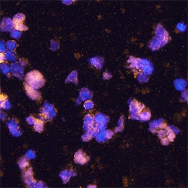 B7-H7/HHLA2 was detected in immersion fixed human peripheral blood mononuclear cells (PBMCs) using Mouse Anti-HumanB7-H7/HHLA2 Monoclonal Antibody (Catalog # MAB8084) at 25 µg/mL for 3 hours at room temperature. Cells were stained using the NorthernLights™ 557-conjugated Anti-Mouse IgG Secondary Antibody (yellow; Catalog # NL007) and counterstained with DAPI (blue). Specific staining was localized to cytoplasm. View our protocol for Fluorescent ICC Staining of Non-adherent Cells.