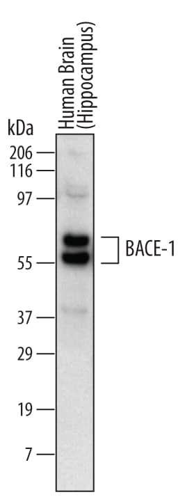 Western Blot BACE-1 Antibody (137612)