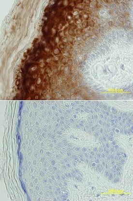 BACE-2 was detected in immersion fixed paraffin-embedded sections of human skin using Rat Anti-Human BACE-2 Ectodomain Monoclonal Antibody (Catalog # MAB4097) at 25 µg/mL overnight at 4 °C. Tissue was stained using the Anti-Rat HRP-DAB Cell & Tissue Staining Kit (brown; Catalog # CTS017) and counterstained with hematoxylin (blue). Lower panel shows a lack of labeling if primary antibodies are omitted and tissue is stained only with secondary antibody followed by incubation with detection reagents. View our protocol for Chromogenic IHC Staining of Paraffin-embedded Tissue Sections.