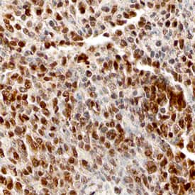 Immunohistochemistry BACH1 Antibody