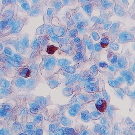 BAFF/BLyS/TNFSF13B was detected in formalin fixed paraffin-embedded sections of human spleen using 15 µg/mL Goat Anti-Human BAFF/BLyS/TNFSF13B Antigen Affinity-purified Polyclonal Antibody (Catalog # AF124) overnight at 4 °C. Tissue was stained with the Anti-Goat HRP-DAB Cell & Tissue Staining Kit (brown; Catalog # CTS008) and counterstained with hematoxylin (blue). View our protocol for Chromogenic IHC Staining of Paraffin-embedded Tissue Sections.