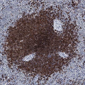 Immunohistochemistry BAFFR/TNFRSF13C Antibody [Unconjugated]