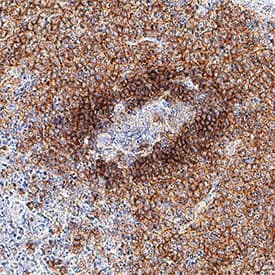 Immunohistochemistry BAFFR/TNFRSF13C Antibody (2403C) [Unconjugated]