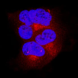 BAK was detected in immersion fixed HEK293 human embryonic kidney cell line using Goat Anti-Human/Mouse/Rat BAK Antigen Affinity-purified Polyclonal Antibody (Catalog # AF8161) at 15 µg/mL for 3 hours at room temperature. Cells were stained using the NorthernLights™ 557-conjugated Anti-Goat IgG Secondary Antibody (red; NL001) and counterstained with DAPI (blue). Specific staining was localized to cytoplasm. View our protocol for Fluorescent ICC Staining of Cells on Coverslips.