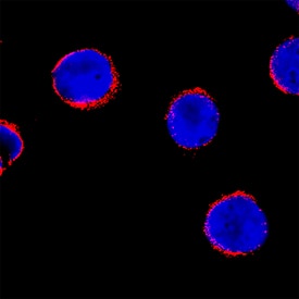 BAK was detected in immersion fixed Jurkat human acute T cell leukemia cell line using Mouse Anti-Human BAK Monoclonal Antibody (Catalog # MAB8161) at 8 µg/mL for 3 hours at room temperature. Cells were stained using the NorthernLights™ 557-conjugated Anti-Mouse IgG Secondary Antibody (red; Catalog # NL007) and counterstained with DAPI (blue). Specific staining was localized to cytoplasm. View our protocol for Fluorescent ICC Staining of Cells on Coverslips.