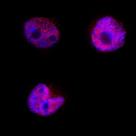 BATF3 was detected in immersion fixed HDLM-2 human Hodgkin's lymphoma cell line using Sheep Anti-Human BATF3 Antigen Affinity-purified Polyclonal Antibody (Catalog # AF7437) at 5 µg/mL for 3 hours at room temperature. Cells were stained using the NorthernLights™ 557-conjugated Anti-Sheep IgG Secondary Antibody (red; Catalog # NL010) and counterstained with DAPI (blue). Specific staining was localized to cytoplasm and nuclei. View our protocol for Fluorescent ICC Staining of Non-adherent Cells.