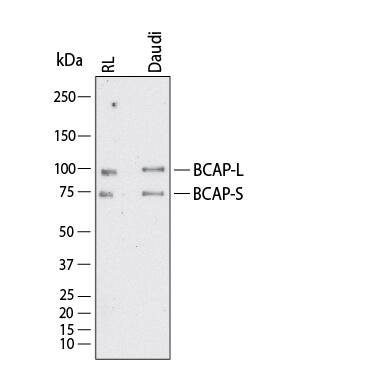 Western Blot shows lysates of RL human non-Hodgkin's lymphoma B cell line and Daudi human Burkitt's lymphoma cell line. PVDF membrane was probed with 2 µg/ml of Mouse Anti-Human/Mouse BCAP Monoclonal Antibody (Catalog # MAB4857) followed by HRP-conjugated Anti-Mouse IgG Secondary Antibody (Catalog # HAF018). Specific bands were detected for BCAP at approximately 80 kDa and 100 kDa (as indicated).  This experiment was conducted under reducing conditions and using Western Blot Buffer Group 1.
