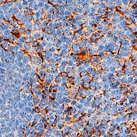 BCMA/TNFRSF17 was detected in immersion fixed paraffin-embedded sections of human tonsil using Mouse Anti-Human BCMA/TNFRSF17 Monoclonal Antibody (Catalog # MAB1931) at 5 µg/mL for 1 hour at room temperature followed by incubation with the Anti-Mouse IgG VisUCyte™ HRP Polymer Antibody (Catalog # VC001). Before incubation with the primary antibody, tissue was subjected to heat-induced epitope retrieval using Antigen Retrieval Reagent-Basic (Catalog # CTS013). Tissue was stained using DAB (brown) and counterstained with hematoxylin (blue). Specific staining was localized to plasma membrane. View our protocol for IHC Staining with VisUCyte HRP Polymer Detection Reagents.