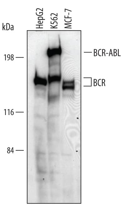 Western Blot BCR Antibody
