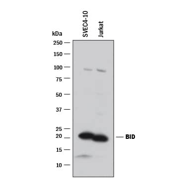Western Blot BID Antibody [Unconjugated]