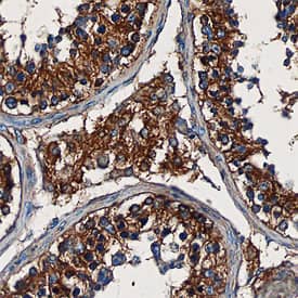 BLMH/Bleomycin Hydrolase was detected in immersion fixed paraffin-embedded sections of human testis using Mouse Anti-Human BLMH/Bleomycin Hydrolase Monoclonal Antibody (Catalog # MAB6200) at 15 µg/mL overnight at 4 °C. Tissue was stained using the Anti-Mouse HRP-DAB Cell & Tissue Staining Kit (brown; Catalog # CTS002) and counterstained with hematoxylin (blue). Specific staining was localized to spermatocytes. View our protocol for Chromogenic IHC Staining of Paraffin-embedded Tissue Sections.