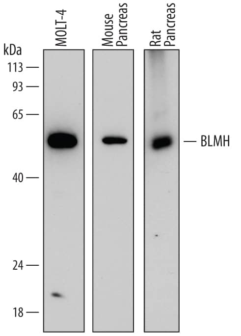 Western blot shows lysates of MOLT-4 human acute lymphoblastic leukemia cell line, mouse pancreas tissue, and rat pancreas tissue. PVDF membrane was probed with 0.2 µg/mL of Mouse Anti-Human BLMH/Bleomycin Hydrolase Monoclonal Antibody (Catalog # MAB6200) followed by HRP-conjugated Anti-Mouse IgG Secondary Antibody (Catalog # HAF018). A specific band was detected for BLMH/Bleomycin Hydrolase at approximately 52 kDa (as indicated). This experiment was conducted under reducing conditions and using Immunoblot Buffer Group 1.