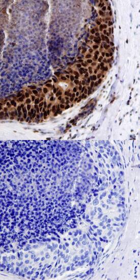 BMI-1 was detected in immersion fixed paraffin-embedded sections of normal human breast using Human BMI-1 Monoclonal Antibody (Catalog # MAB33342) at 15 µg/mL overnight at 4 °C. Tissue was stained using the Anti-Mouse HRP-DAB Cell & Tissue Staining Kit (brown; Catalog # CTS002) and counterstained with hematoxylin (blue). Lower panel shows a lack of labeling if primary antibodies are omitted and tissue is stained only with secondary antibody followed by incubation with detection reagents. View our protocol for Chromogenic IHC Staining of Paraffin-embedded Tissue Sections.