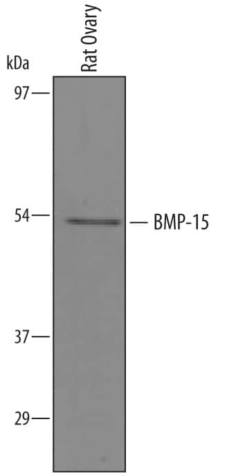 Western blot shows lysates of rat ovary tissue. PVDF membrane was probed with 1 µg/mL of Sheep Anti-Mouse/Rat BMP-15/GDF-9B Antigen Affinity-purified Polyclonal Antibody (Catalog # AF5917) followed by HRP-conjugated Anti-Sheep IgG Secondary Antibody (Catalog # HAF016). A specific band was detected for BMP-15/GDF-9B proprecursor at approximately 54 kDa (as indicated). This experiment was conducted under reducing conditions and using Immunoblot Buffer Group 8.