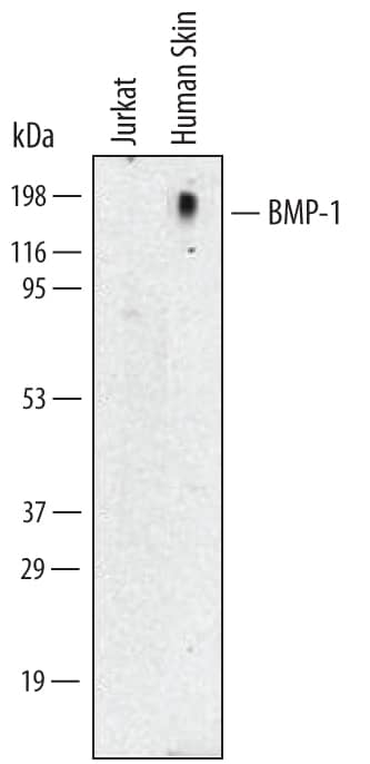 Western Blot BMP-1/PCP Antibody (264822)