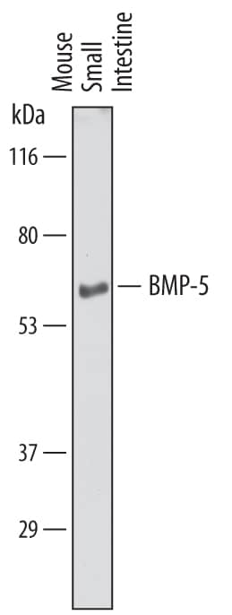 Western blot shows lysates of mouse small intestine tissue. PVDF membrane was probed with 1 µg/mL of Sheep Anti-Human/Mouse BMP-5 Antigen Affinity-purified Polyclonal Antibody (Catalog # AF6176) followed by HRP-conjugated Anti-Sheep IgG Secondary Antibody (Catalog # HAF016). A specific band was detected for BMP-5 at approximately 60 kDa (as indicated). This experiment was conducted under reducing conditions and using Immunoblot Buffer Group 1.