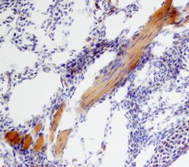 BMP-6 was detected in immersion fixed frozen sections of mouse embryo (15 d.p.c.) using Sheep Anti-Mouse BMP-6 Antigen Affinity-purified Polyclonal Antibody (Catalog # AF6325) at 15 µg/mL overnight at 4 °C. Tissue was stained using the Anti-Sheep HRP-DAB Cell & Tissue Staining Kit (brown; Catalog # CTS019) and counterstained with hematoxylin (blue). Specific staining was localized to skeletal muscle cells. View our protocol for Chromogenic IHC Staining of Frozen Tissue Sections.
