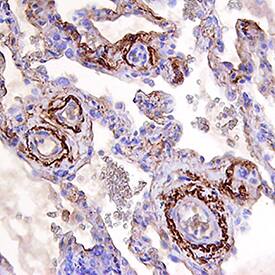 BMP-6 was detected in immersion fixed paraffin-embedded sections of human lung using Goat Anti-Human BMP-6 Antigen Affinity-purified Polyclonal Antibody (Catalog # AF507) at 15 µg/mL overnight at 4 °C. Tissue was stained using the Anti-Goat HRP-DAB Cell & Tissue Staining Kit (brown; Catalog # CTS008) and counterstained with hematoxylin (blue). Specific staining was localized to smooth muscle in vasculature. View our protocol for Chromogenic IHC Staining of Paraffin-embedded Tissue Sections.