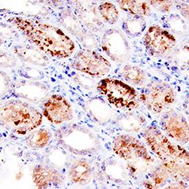 BMP-7 was detected in immersion fixed paraffin-embedded sections of human kidney using Mouse Anti-Human BMP-7 Monoclonal Antibody (Catalog # MAB3541) at 15 µg/mL overnight at 4 °C. Tissue was stained using the Anti-Mouse HRP-DAB Cell & Tissue Staining Kit (brown; Catalog # CTS002) and counterstained with hematoxylin (blue). Specific staining was localized to cytoplasm in convoluted tubules. View our protocol for Chromogenic IHC Staining of Paraffin-embedded Tissue Sections.