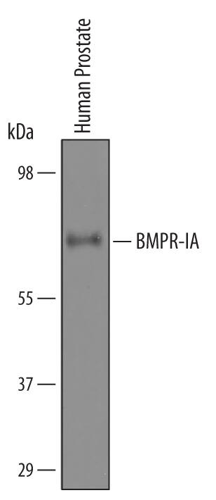 Western blot shows lysates of human skeletal muscle tissue. PVDF membrane was probed with 2 µg/mL of Goat Anti-Human BMPR-IA/ALK-3 Antigen Affinity-purified Polyclonal Antibody (Catalog # AF346) followed by HRP-conjugated Anti-Goat IgG Secondary Antibody (HAF017). A specific band was detected for BMPR-IA/ALK-3 at approximately 60 kDa (as indicated). This experiment was conducted under reducing conditions and using Immunoblot Buffer Group 1.