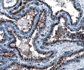 BMPR-IA/ALK-3 was detected in immersion fixed paraffin-embedded sections of human prostate using Mouse Anti-Human BMPR-IA/ALK-3 Monoclonal Antibody (Catalog # MAB24061) at 25 µg/mL overnight at 4 °C. Tissue was stained using the Anti-Mouse HRP-DAB Cell & Tissue Staining Kit (brown; Catalog # CTS002) and counterstained with hematoxylin (blue). Specific staining was localized to cytoplasm in epithelial cells. View our protocol for Chromogenic IHC Staining of Paraffin-embedded Tissue Sections.