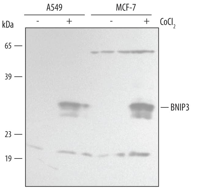 Western blot shows lysates of A549 human lung carcinoma cell line and MCF-7 human breast cancer cell line untreated (-) or treated (+) with 150 µM CoCl2for 16 hours. PVDF membrane was probed with 1 µg/mL of Human BNIP3 Antigen Affinity-purified Polyclonal Antibody (Catalog # AF4147), followed by HRP-conjugated Anti-Goat IgG Secondary Antibody (Catalog # HAF109). A specific band was detected for BNIP3 at approximately 30 kDa (as indicated). This experiment was conducted under reducing conditions and using Immunoblot Buffer Group 2.