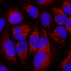 <b>Biological Strategies Validation. </b>BNIP3 was detected in immersion fixed HeLa human cervical epithelial carcinoma cell line using Mouse Anti-Human BNIP3 Polyclonal Antibody (Catalog # MAB41471) at 8 µg/mL for 3 hours at room temperature. Cells were stained using the NorthernLights™ 557-conjugated Anti-Mouse IgG Secondary Antibody (red; Catalog # NL007) and counterstained with DAPI (blue). Specific staining was localized to cytoplasm. View our protocol for Fluorescent ICC Staining of Cells on Coverslips.