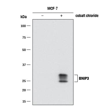 Western blot shows lysates of MCF-7 human breast cancer cell line untreated (-) or treated (+) with CoCl2.PVDF membrane was probed with 0.5 µg/mL of Mouse Anti-Human BNIP3 Polyclonal Antibody (Catalog # MAB41471) followed by HRP-conjugated Anti-Mouse IgG Secondary Antibody (Catalog # HAF018). Specific bands were detected for BNIP3 at approximately 25-30 kDa (as indicated). This experiment was conducted under reducing conditions and using Immunoblot Buffer Group 1.