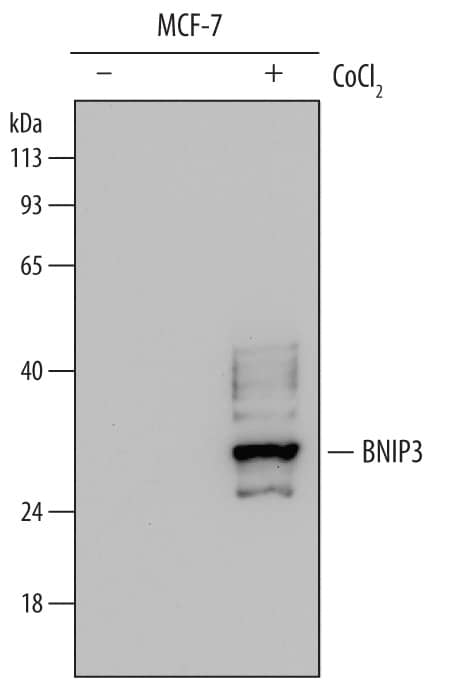 Western blot shows lysates of MCF-7 human breast cancer cell line untreated (-) or treated (+) with 150 µM CoCl2for 18 hours. PVDF membrane was probed with 0.5 µg/mL of Mouse Anti-Human BNIP3 Monoclonal Antibody (Catalog # MAB4147) followed by HRP-conjugated Anti-Mouse IgG Secondary Antibody (Catalog # HAF007). A specific band was detected for BNIP3 at approximately 30 kDa (as indicated). This experiment was conducted under reducing conditions and using Immunoblot Buffer Group 1.