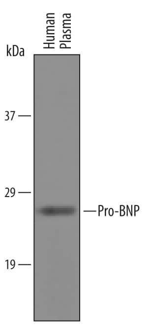 Western blot shows lysates of human plasma. PVDF Membrane was probed with 1 µg/mL of Goat Anti-Human Pro-BNP Antigen Affinity-purified Polyclonal Antibody (Catalog # AF3604) followed by HRP-conjugated Anti-Goat IgG Secondary Antibody (Catalog # HAF019). A specific band was detected for Pro-BNP at approximately 27 kDa (as indicated). This experiment was conducted under reducing conditions and using Immunoblot Buffer Group 1.