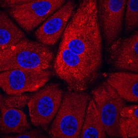 BNP was detected in immersion fixed BG01V human embryonic stem cells using Rat Anti-Human Pro-BNP Monoclonal Antibody (Catalog # MAB36041) at 10 µg/mL for 3 hours at room temperature. Cells were stained using the NorthernLights™ 557-conjugated Anti-Rat IgG Secondary Antibody (red; Catalog # NL013) and counterstained with DAPI (blue). Specific staining was localized to cytoplasm. View our protocol for Fluorescent ICC Staining of Cells on Coverslips.