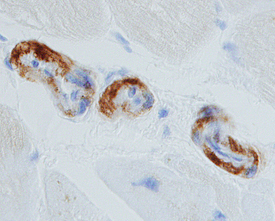 Pro-BNP was detected in immersion fixed paraffin-embedded sections of human heart using 25 µg/mL Rat Anti-Human Pro-BNP Monoclonal Antibody (Catalog # MAB36041) overnight at 4 °C. Tissue was stained with the Anti-Rat HRP-DAB Cell & Tissue Staining Kit (brown; Catalog # CTS017) and counterstained with hematoxylin (blue). Specific labeling was localized to endothelial cells in the vasculature. View our protocol for Chromogenic IHC Staining of Paraffin-embedded Tissue Sections.