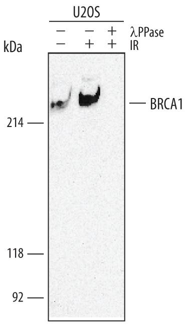 Western blot shows lysates of U2OS human osteosarcoma cell line mock treated or exposed to 10 Gy IR for 1 hour. PVDF membrane was probed with 0.5 µg/mL Rabbit Anti-Human Phospho-BRCA1 (S1423) Antigen Affinity-purified Polyclonal Antibody (Catalog # AF1386) followed by HRP-conjugated Anti-Rabbit IgG Secondary Antibody (Catalog # HAF008). A specific band for Phospho-BRCA1 (S1423) was detected at approximately 220 kDa (as indicated). The phospho-specificity of this antibody was supported by decreased labeling following treatment with 600 U lambda-phosphatase (lambda-PPase) for 1 hour. This experiment was conducted under reducing conditions and using Immunoblot Buffer Group 1.