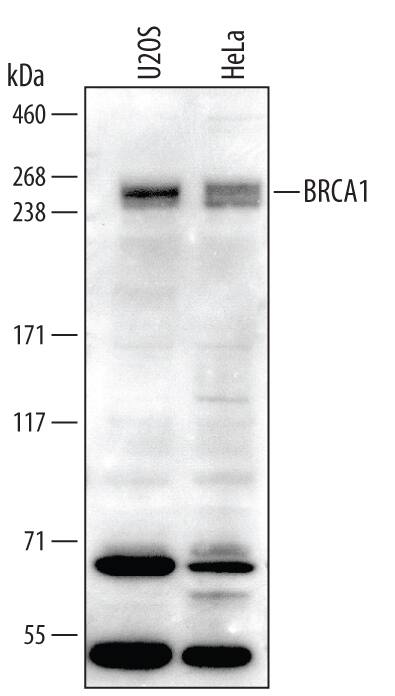 Western blot shows lysates of U2OS human osteosarcoma cell line and HeLa human cervical epithelial carcinoma cell line. PVDF membrane was probed with 1 µg/mL of Goat Anti-human BRCA1 Antigen Affinity-purified Polyclonal Antibody (Catalog # AF2210) followed by HRP-conjugated Anti-Goat IgG Secondary Antibody (Catalog # HAF109). A specific band was detected for BRCA1 at approximately 250 kDa (as indicated). This experiment was conducted under reducing conditions and using Immunoblot Buffer Group 1.