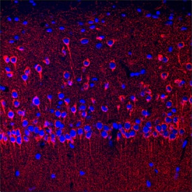 SEZ6/BSRP-C was detected in perfusion fixed frozen sections of mouse brain (hippocampus) using Sheep Anti-Mouse SEZ6/BSRP-C Antigen Affinity-purified Polyclonal Antibody (Catalog # AF4989) at 10 µg/mL overnight at 4 °C. Tissue was stained using the NorthernLights™ 557-conjugated Anti-Sheep IgG Secondary Antibody (red; Catalog # NL010) and counterstained with DAPI (blue). Specific staining was localized to neuronal cell bodies, processes, and synaptic puncta. View our protocol for Fluorescent IHC Staining of Frozen Tissue Sections.