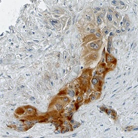 Immunohistochemistry BTF3 Antibody