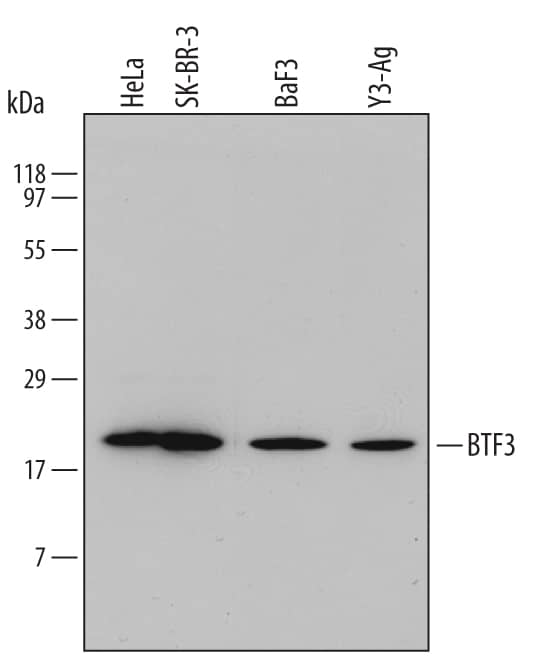 Western Blot BTF3 Antibody