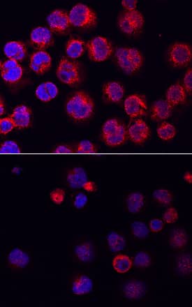 <b>Biological Strategies Validation. </b>BTK phosphorylated at Y223 was detected in immersion fixed Raji human Burkitt's lymphoma cell line with (upper panel) and without (lower panel) pervanadate stimulation using Mouse Anti-Human Phospho-BTK (Y223) Monoclonal Antibody (Catalog # MAB7205) at 10 µg/mL for 3 hours at room temperature. Cells were stained using the NorthernLights™ 557-conjugated Anti-Mouse IgG Secondary Antibody (red; Catalog # NL007) and counterstained with DAPI (blue). Specific staining was localized to cytoplasm. View our protocol for Fluorescent ICC Staining of Non-adherent Cells.