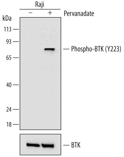 Western blot shows lysates of Raji human Burkitt's lymphoma cell line untreated (-) or treated (+) with 1 mM Pervanadate for 30 minutes. PVDF membrane was probed with 1 µg/mL of Mouse Anti-Human Phospho-BTK (Y223) Monoclonal Antibody (Catalog # MAB7205) followed by HRP-conjugated Anti-Mouse IgG Secondary Antibody (Catalog # HAF007). A specific band was detected for Phospho-BTK (Y223) at approximately 80 kDa (as indicated). For additional reference, duplicate samples were probed with 0.05 µg/mL of Mouse Anti-Human BTK Monoclonal Antibody (lower panel, Catalog # MAB5807) This experiment was conducted under reducing conditions and using Immunoblot Buffer Group 1.