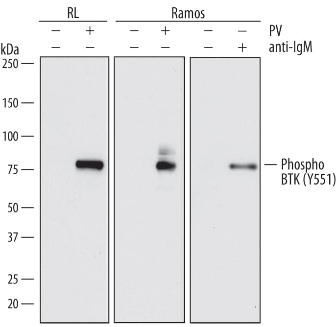 Western blot shows lysates of RL human non-Hodgkin's lymphoma B cell line and Ramos human Burkitt's lymphoma cell line untreated (-) or treated (+) with 0.1 mM Pervanadate (PV) for 10 minutes and 12 µg/mL Goat Anti-Human IgM µ Chain Antigen Affinity-purified Polyclonal Antibody (Catalog # G-105-C) for 2 minutes. PVDF membrane was probed with 1 µg/mL of Mouse Anti-Human Phospho-BTK (Y551) Monoclonal Antibody (Catalog # MAB7659) followed by HRP-conjugated Anti-Mouse IgG Secondary Antibody (Catalog # HAF018). A specific band was detected for Phospho-BTK (Y551) at approximately 75 kDa (as indicated). This experiment was conducted under reducing conditions and using Immunoblot Buffer Group 1.