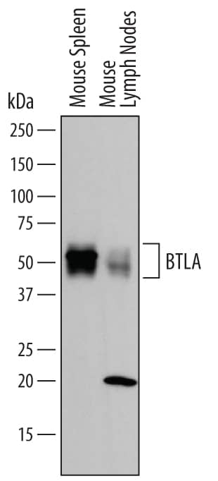 Western Blot BTLA/CD272 Antibody