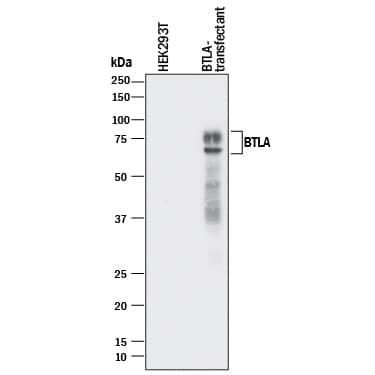Western Blot BTLA/CD272 Antibody [Unconjugated]