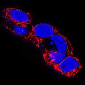 BTN1A1/Butyrophilin was detected in immersion fixed HEK293 human embryonic kidney cell line using Rabbit Anti-Human BTN1A1/Butyrophilin Polyclonal Antibody (Catalog # MAB84671) at 0.3 µg/mL for 3 hours at room temperature. Cells were stained using the NorthernLights™ 557-conjugated Anti-Rabbit IgG Secondary Antibody (red; Catalog # NL004) and counterstained with DAPI (blue). Specific staining was localized to cytoplasm. View our protocol for Fluorescent ICC Staining of Cells on Coverslips.