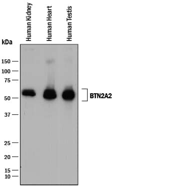 Western Blot BTN2A2/Butyrophilin 2 Antibody [Unconjugated]