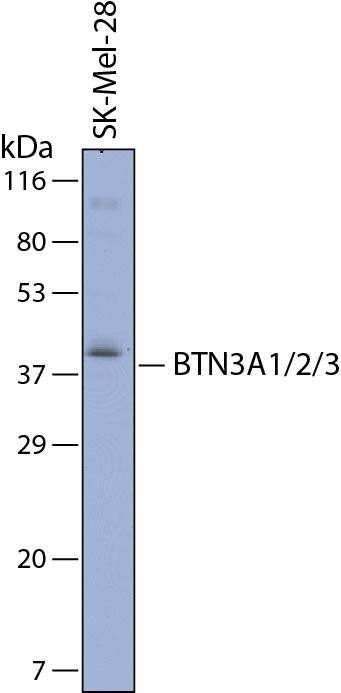 Western blot shows lysates of SK-Mel-28 human malignant melanoma cell line. PVDF membrane was probed with 1 µg/mL of Sheep Anti-Human BTN3A1/2/3 Antigen Affinity-purified Polyclonal Antibody (Catalog # AF7136) followed by HRP-conjugated Anti-Sheep IgG Secondary Antibody (Catalog # HAF016). A specific band was detected for BTN3A1/2/3 at approximately 40 kDa (as indicated). This experiment was conducted under reducing conditions and using Immunoblot Buffer Group 8.