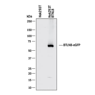 Western Blot BTNL8 Antibody (2187B) [Unconjugated]