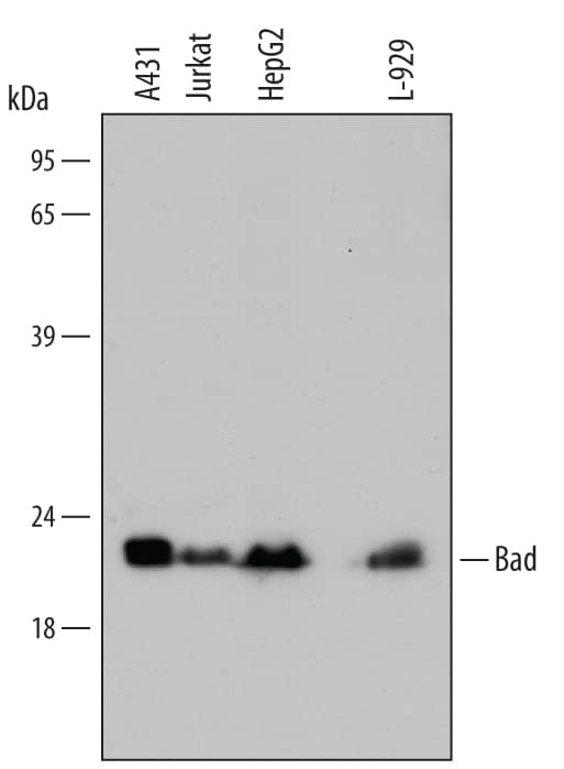 Western blot shows lysates of A431 human epithelial carcinoma cell line, Jurkat human acute T cell leukemia cell line, HepG2 human hepatocellular carcinoma cell line, and L-929 mouse fibroblast cell line. PVDF membrane was probed with 1 µg/mL of Rabbit Anti-Human/Mouse Bad Antigen Affinity-purified Polyclonal Antibody (Catalog # AF819) followed by HRP-conjugated Anti-Rabbit IgG Secondary Antibody (Catalog # HAF008). A specific band was detected for Bad at approximately 22 kDa (as indicated). This experiment was conducted under reducing conditions and using Immunoblot Buffer Group 2.