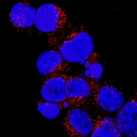 Bad was detected in immersion fixed Jurkat human acute T cell leukemia cell line using Mouse Anti-Human Bad Monoclonal Antibody (Catalog # MAB6405) at 25 µg/mL for 3 hours at room temperature. Cells were stained using the NorthernLights™ 557-conjugated Anti-Mouse IgG Secondary Antibody (red; Catalog # NL007) and counterstained with DAPI (blue). Specific staining was localized to cytoplasm. View our protocol for Fluorescent ICC Staining of Non-adherent Cells.