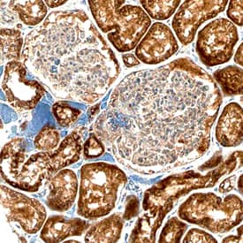 Bad was detected in immersion fixed paraffin-embedded sections of human kidney using Mouse Anti-Human/Mouse/Rat Bad Monoclonal Antibody (Catalog # MAB6405) at 15 µg/mL overnight at 4 °C. Before incubation with the primary antibody, tissue was subjected to heat-induced epitope retrieval using Antigen Retrieval Reagent-Basic (Catalog # CTS013). Tissue was stained using the Anti-Mouse HRP-DAB Cell & Tissue Staining Kit (brown; Catalog # CTS002) and counterstained with hematoxylin (blue). Specific staining was localized to cytoplasm of epithelial cells in convoluted tubules. View our protocol for Chromogenic IHC Staining of Paraffin-embedded Tissue Sections.